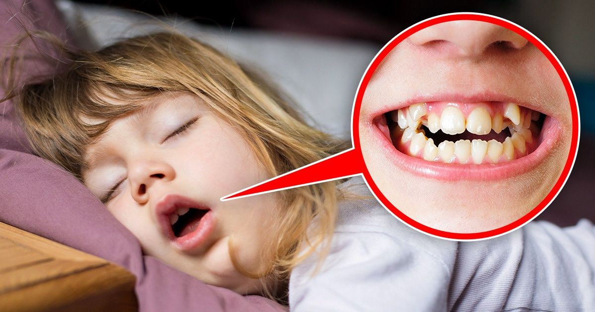 Спать с открытым ртом причины. Дети с открытым ртом. Спящие дети с открытым ртом. Дети спят с открытыми ртами.